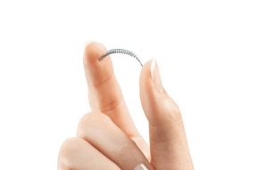 Essure Lawsuit Funding